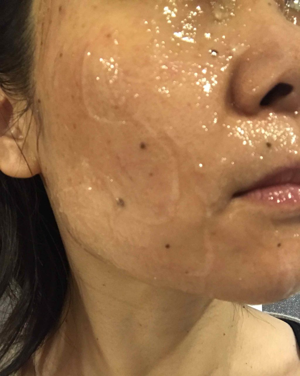 キラキラ☆のクチコミ「#炭酸パック #スパオキシジェル #ドクターメディオン 

@dai2_koho @dai2_.....」（2枚目）