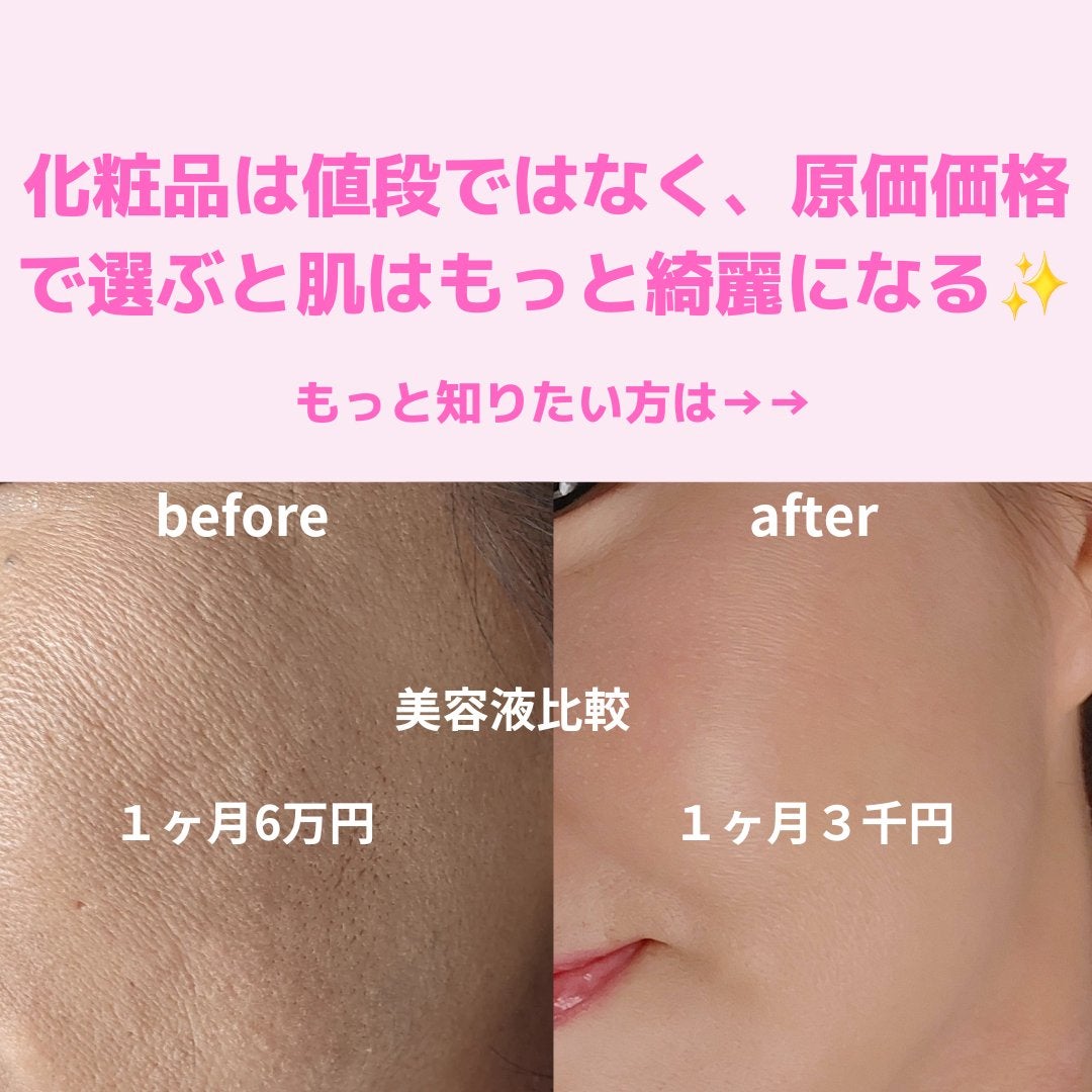 美肌カウンセラー💆肌悩みを解決し見る世界を変える on LIPS 「肌を綺麗にする専門家💆美肌カウンセラーおすすめ\毛穴の悩みは改..」(4枚目)