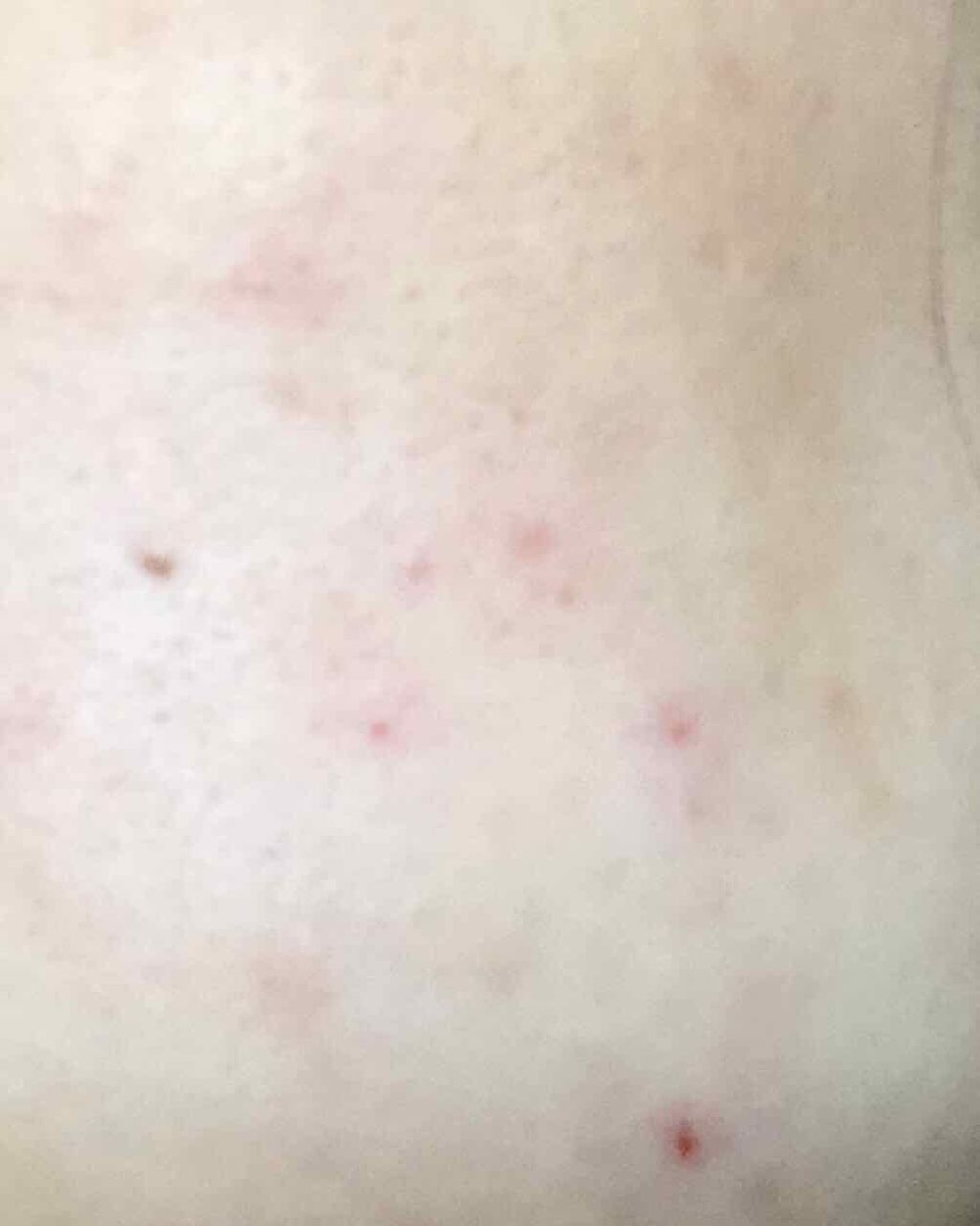 ハトムギオールインワンゲル/プラチナレーベル/オールインワン化粧品を使ったクチコミ（1枚目）