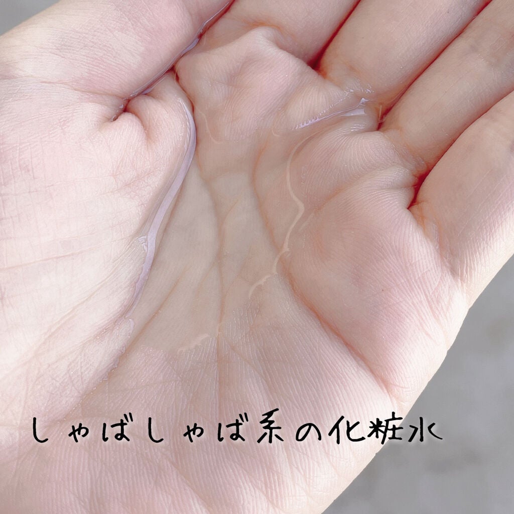 ヘパトリート 薬用保湿化粧水/ゼトックスタイル/化粧水を使ったクチコミ(2枚目)