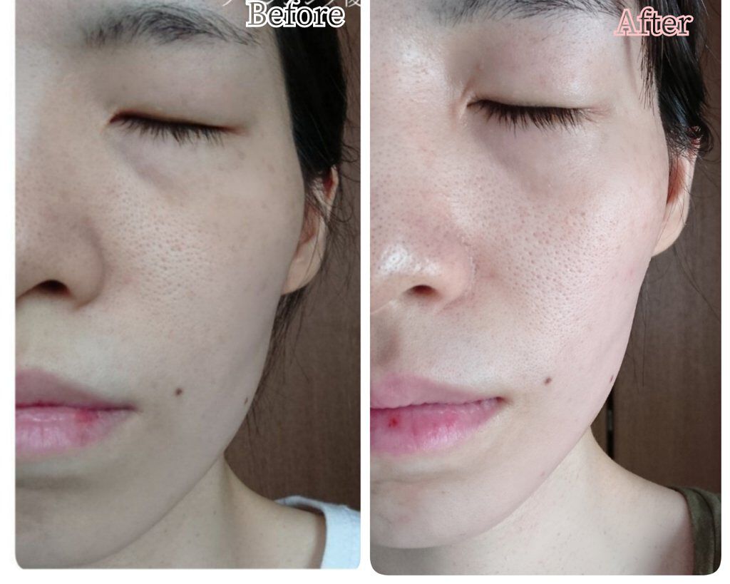 デュオ ザ クレンジングバーム ブラックリペア /DUO/クレンジングバームを使ったクチコミ(7枚目)