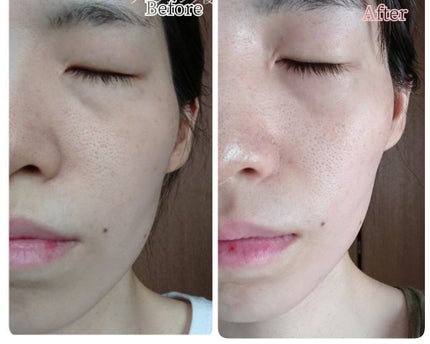 デュオ ザ クレンジングバーム ブラックリペア /DUO/クレンジングバームを使ったクチコミ(7枚目)