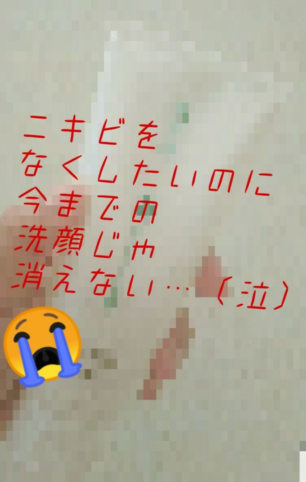 大人のニキビ対策 薬用美白化粧水/肌美精/化粧水を使ったクチコミ（1枚目）