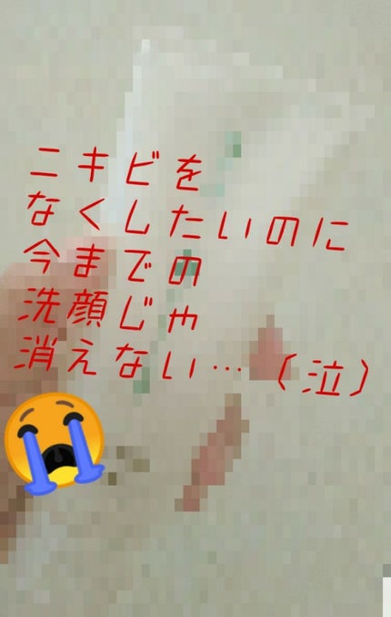 大人のニキビ対策 薬用美白化粧水/肌美精/化粧水を使ったクチコミ(1枚目)