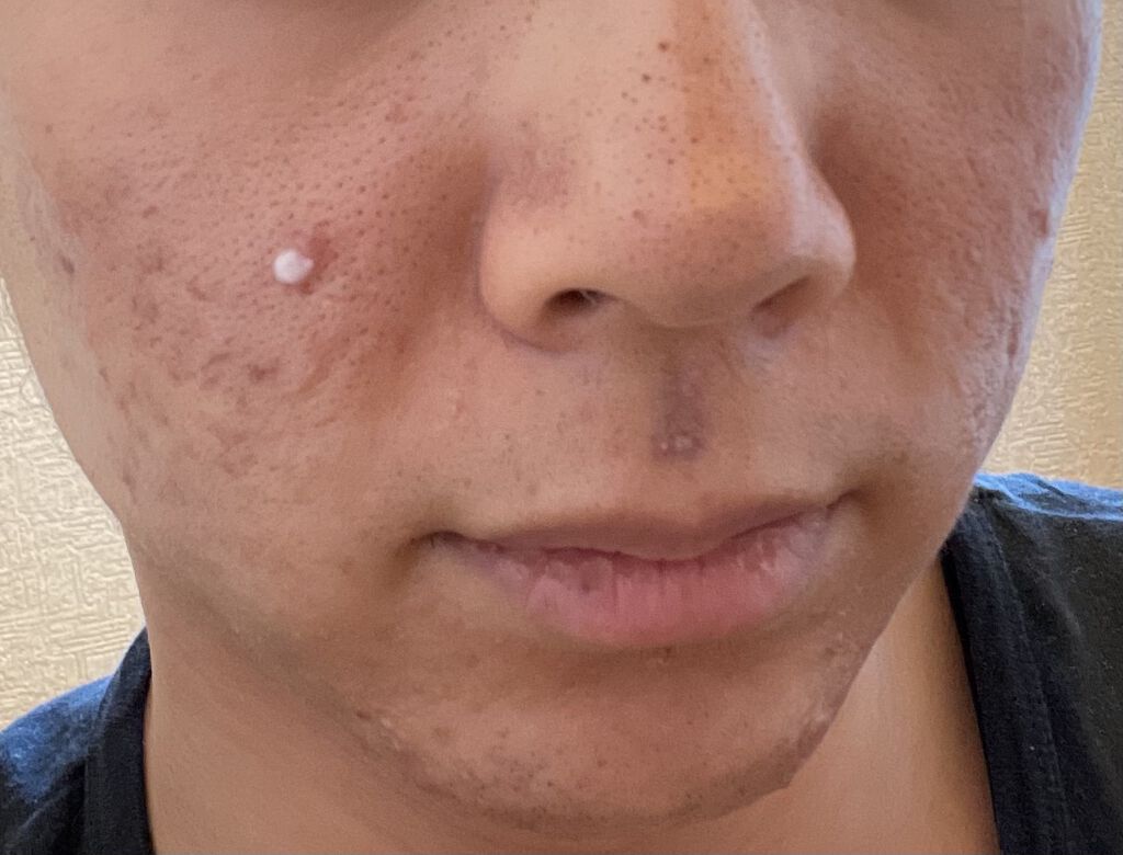 を使ったクチコミ（1枚目）