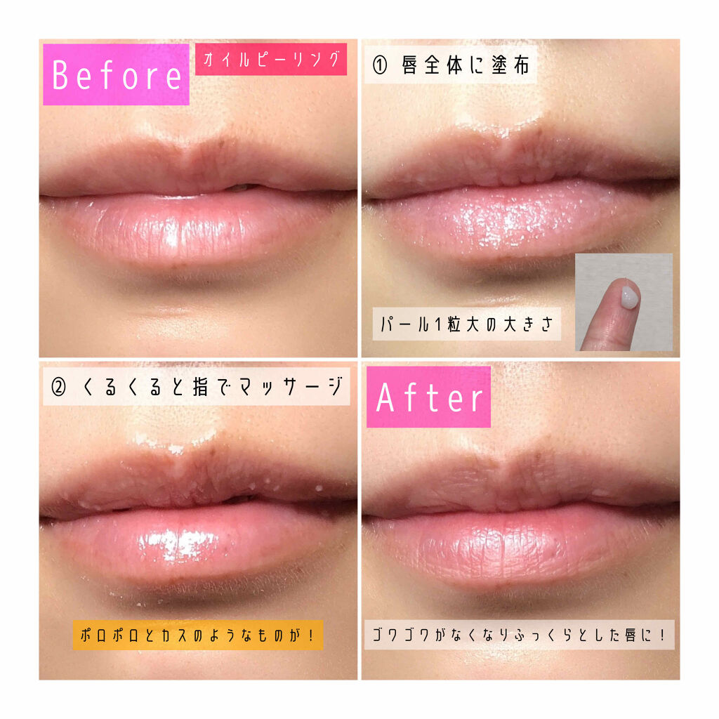 唇のナイトパック/リップルン/リップマスクを使ったクチコミ（3枚目）