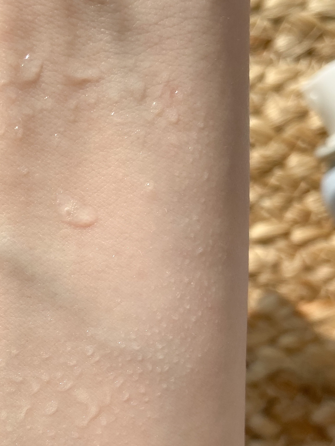 kiso フェイシャルデイミスト GA/KISO/ミスト状化粧水を使ったクチコミ（3枚目）