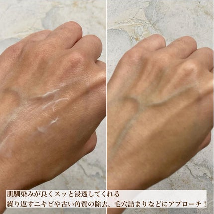 エリー on LIPS 「𓅰𓅰𓅰𓂃𓈒𓂂𓏸𓐍◌⋆꙳ニキビに悩む人にぜひオススメしたい..」(4枚目)