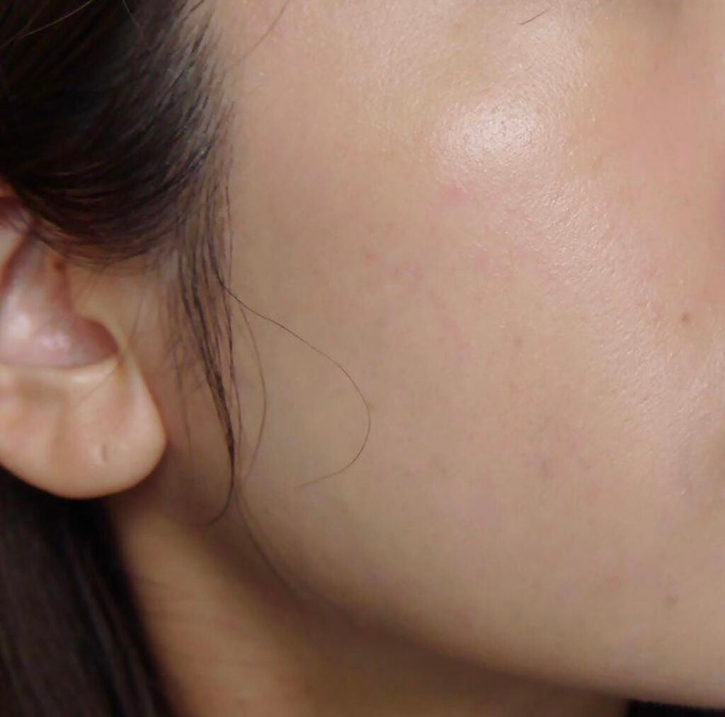 【旧】ディオールスキン フォーエヴァー フルイド グロウ/Dior/リキッドファンデーションを使ったクチコミ(2枚目)