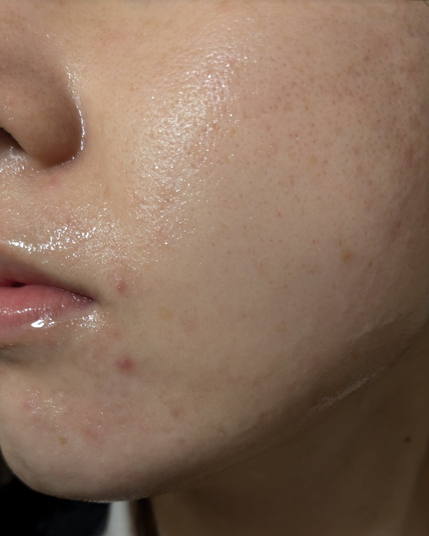 miina@汚肌工事録⚠️ on LIPS 「11/4の#汚肌工事録😂..」(2枚目)