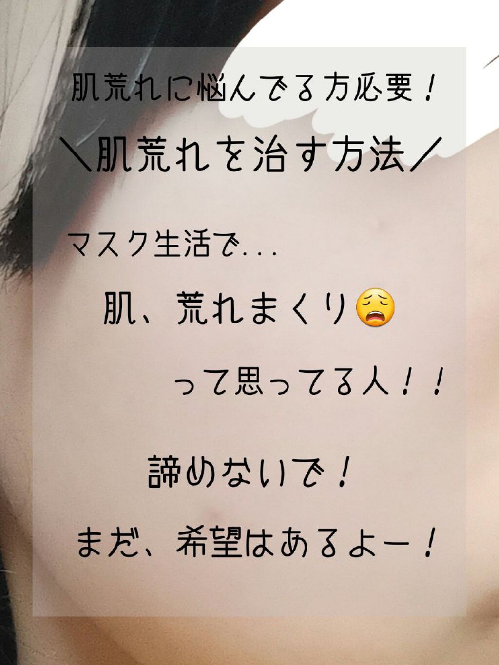 白潤 薬用美白化粧水(しっとりタイプ)/肌ラボ/化粧水を使ったクチコミ（1枚目）