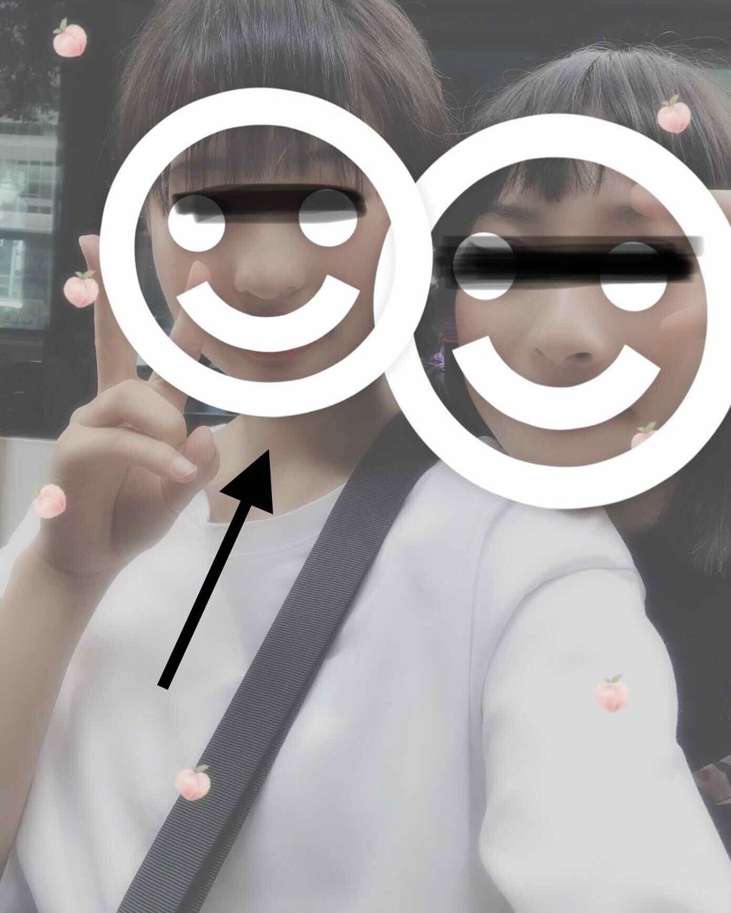 オキシドール(医薬品)/日本薬局方/その他を使ったクチコミ（3枚目）