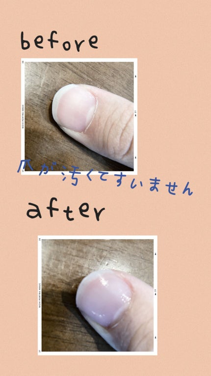 ãã€ã«ã±ã¢ãªã€ã«/ç¡å°è¯å/ãã€ã«ãªã€ã«ã»ããªãŒãã¡ã³ãã䜿ã£ãã¯ãã³ãïŒ3æç®ïŒ