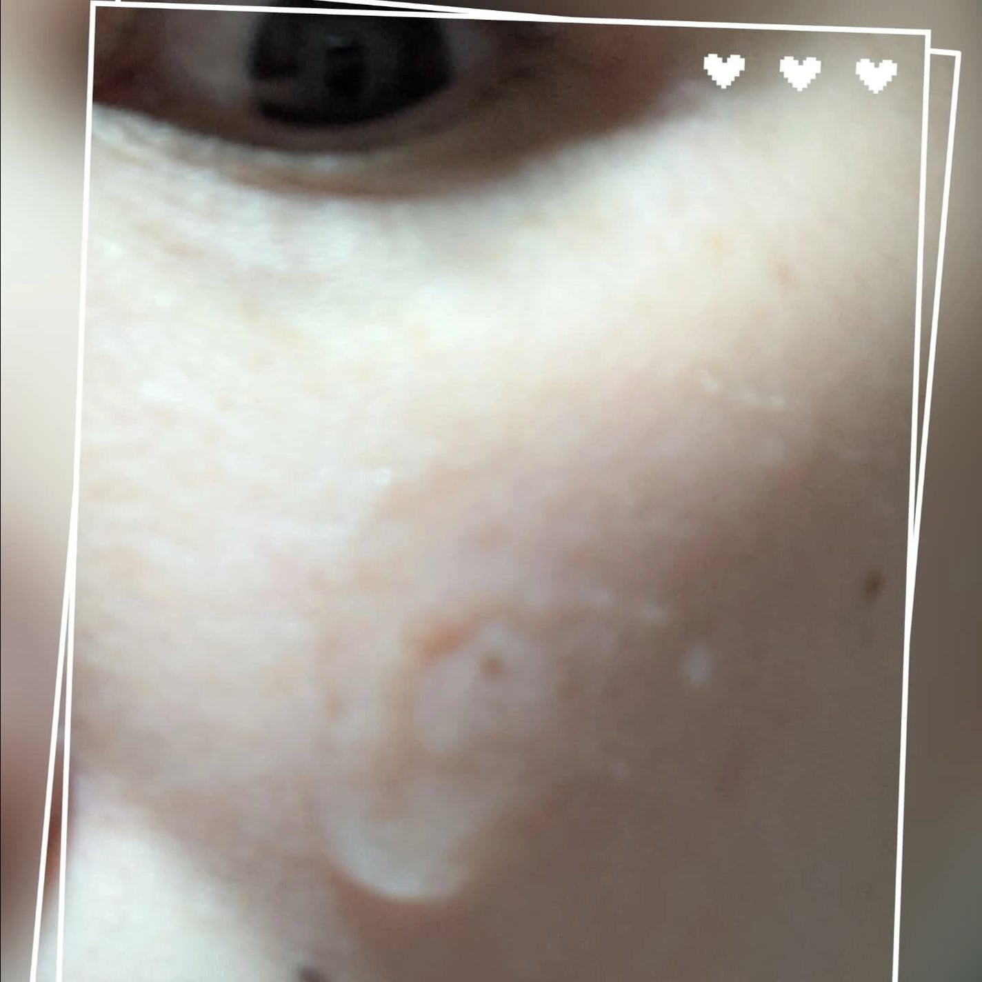 リペアジェル/リソウコーポレーション/美容液を使ったクチコミ(5枚目)