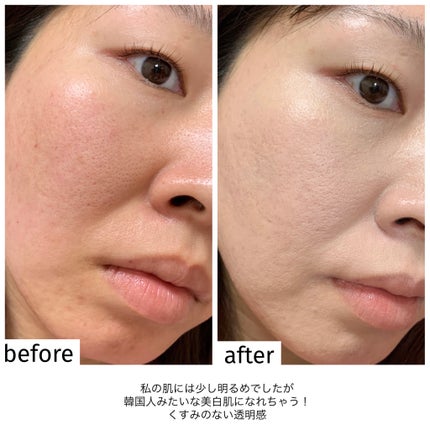 ダーマシンコンシーラー/23years old/リキッドコンシーラーを使ったクチコミ(10枚目)