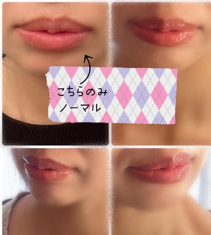 リップバターバーム/ASUNE /リップケアを使ったクチコミ(6枚目)