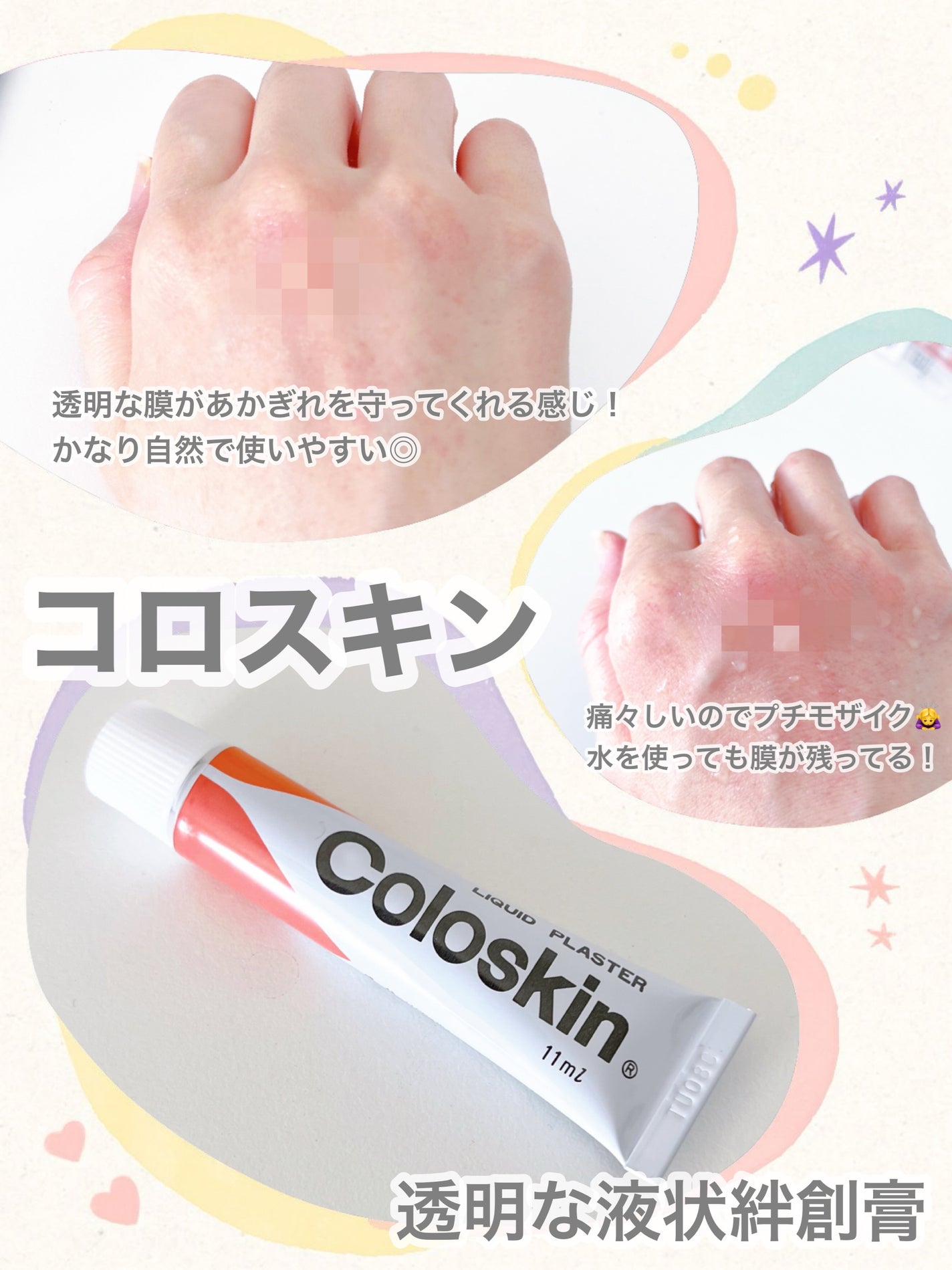 コロスキン(医薬品)/東京甲子社/その他を使ったクチコミ(1枚目)