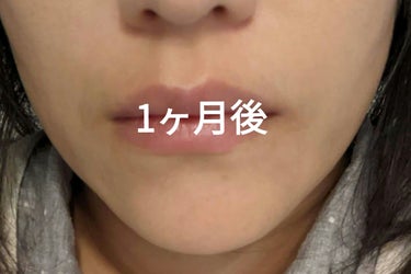 FACIAL FITNESS PAO/MTG/その他スキンケアグッズを使ったクチコミ（3枚目）