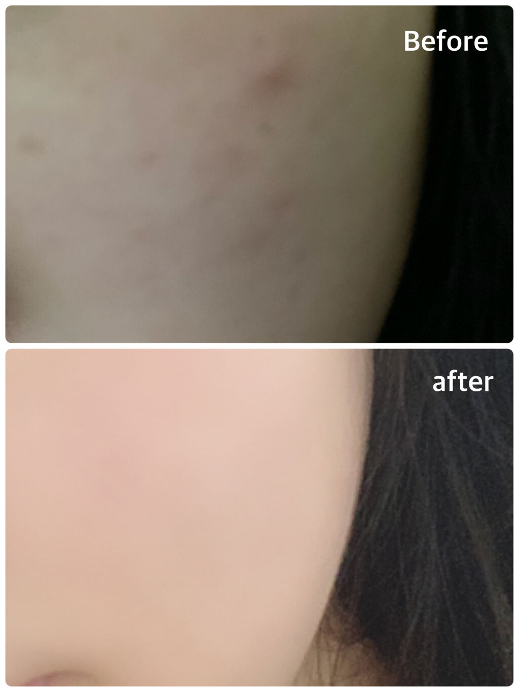 DHC ビタミンＣハードカプセル/DHC/美容サプリメントを使ったクチコミ（2枚目）