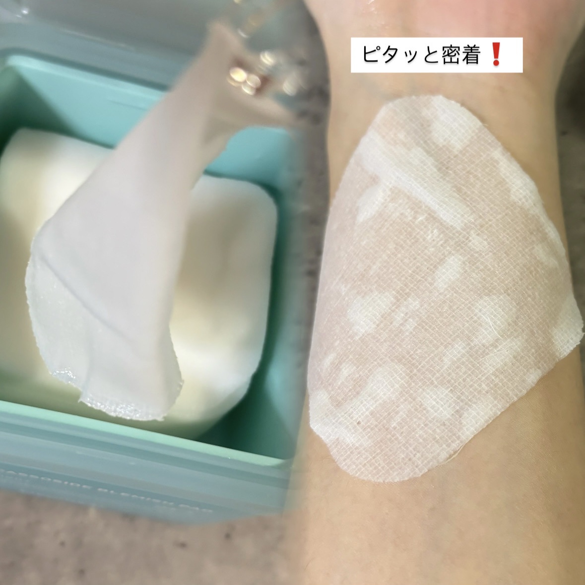 マデカッソシドブレミッシュパッド/MEDIHEAL/トナーパッドを使ったクチコミ（2枚目）