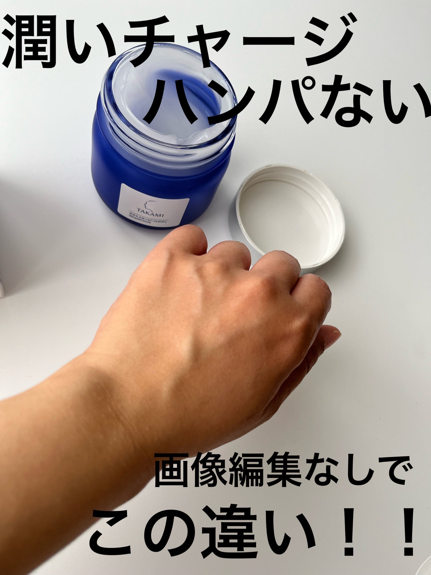 タカミ スキンピールボディ/タカミ/ボディローションを使ったクチコミ(4枚目)