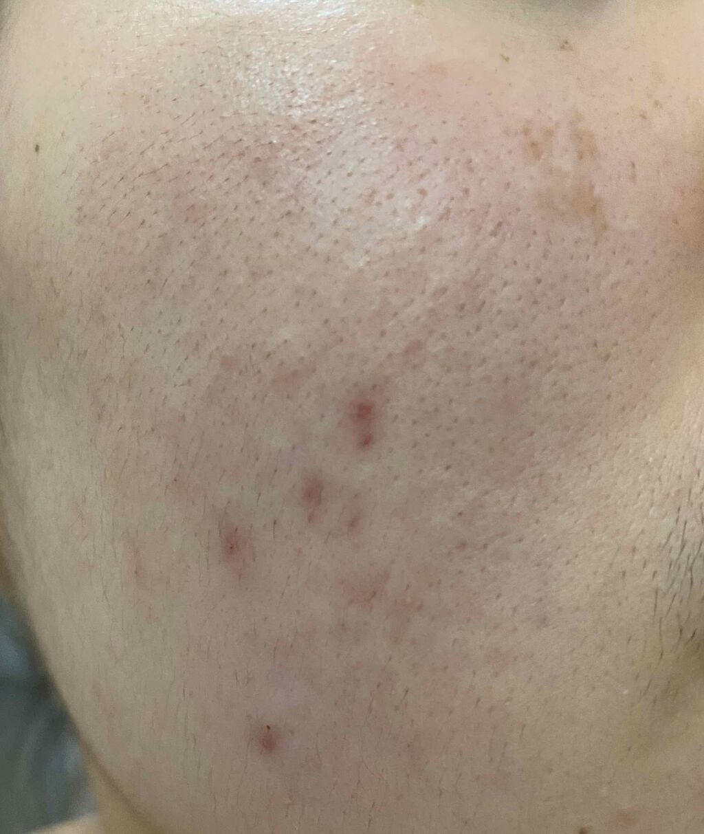 Cセラム/b.glen/美容液を使ったクチコミ（2枚目）