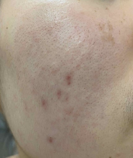 Cセラム/b.glen/美容液を使ったクチコミ(2枚目)