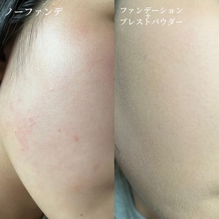 カインド&フリー モイストスキンティント/リンメル ロンドン/リキッドファンデーションを使ったクチコミ(5枚目)