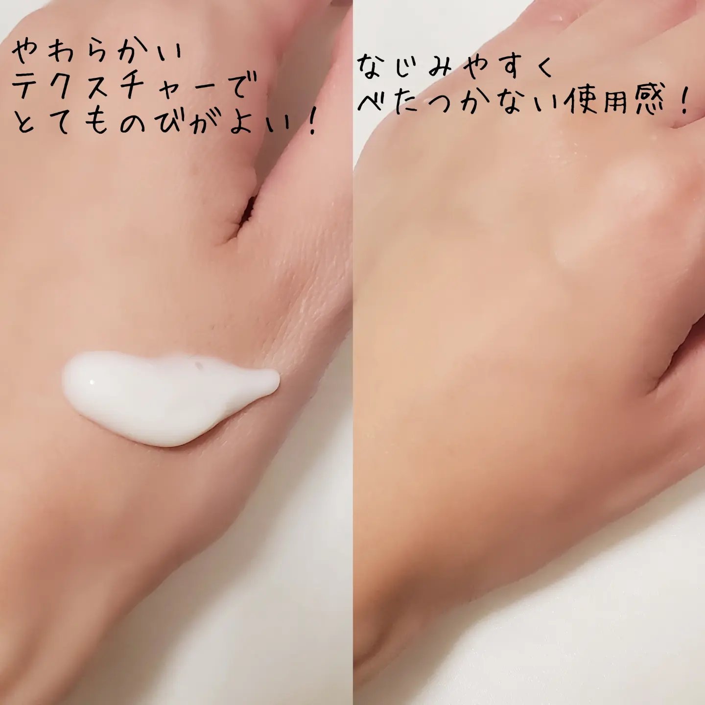 モイスチャーローション/ベビーセバメド/ボディローションを使ったクチコミ（3枚目）