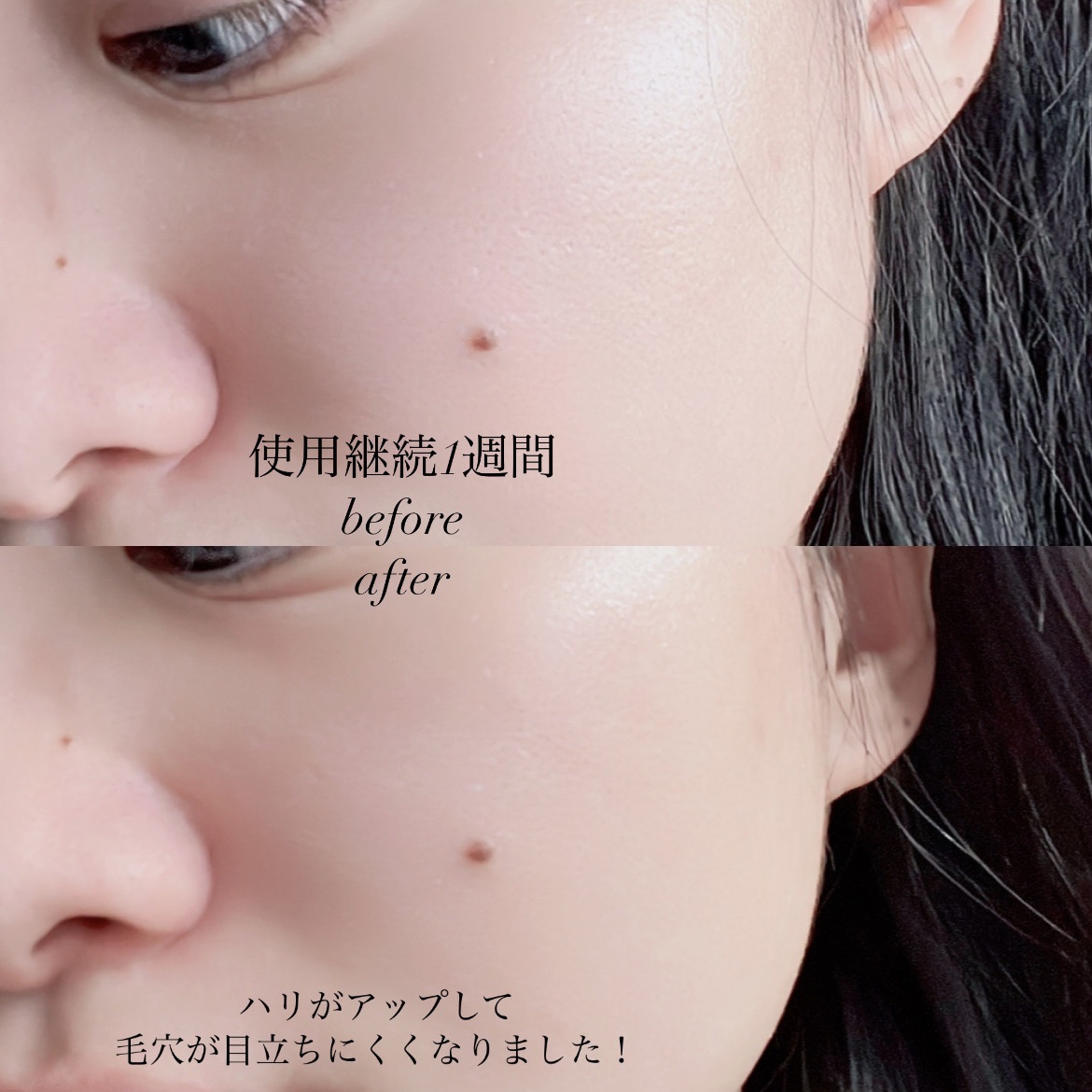 PDRNショット675/COSNORI/美容液を使ったクチコミ（3枚目）