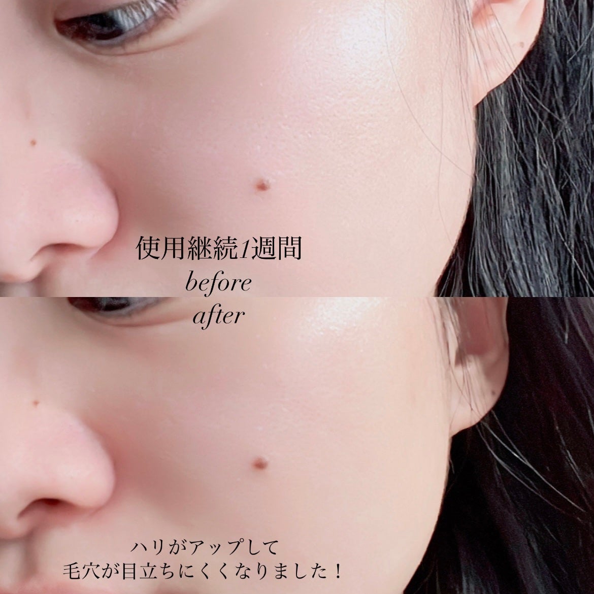 PDRNショット675/COSNORI/美容液を使ったクチコミ(3枚目)