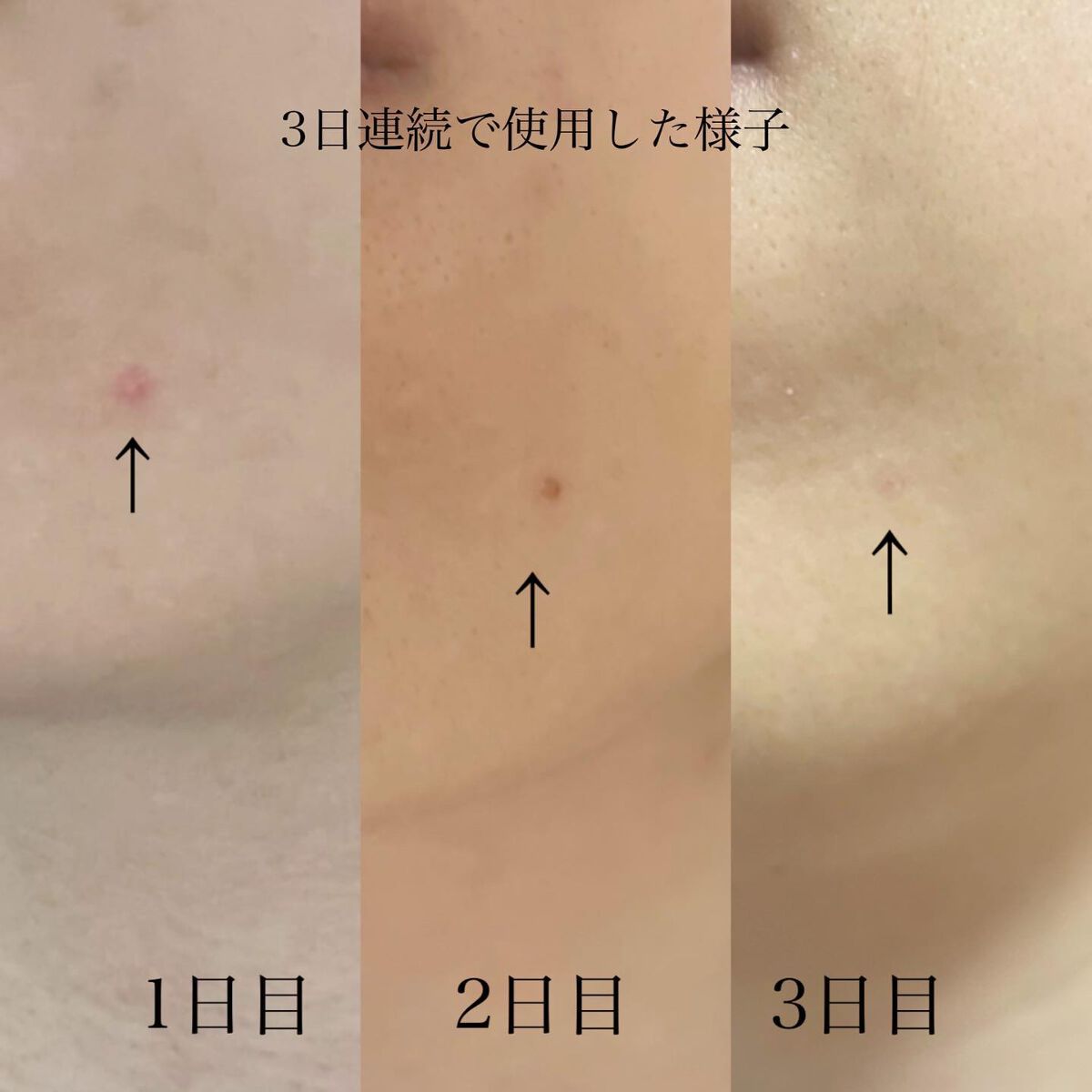 CICA クリーム/VT/フェイスクリームを使ったクチコミ(7枚目)