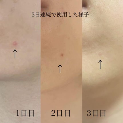 CICA クリーム/VT/フェイスクリームを使ったクチコミ(7枚目)