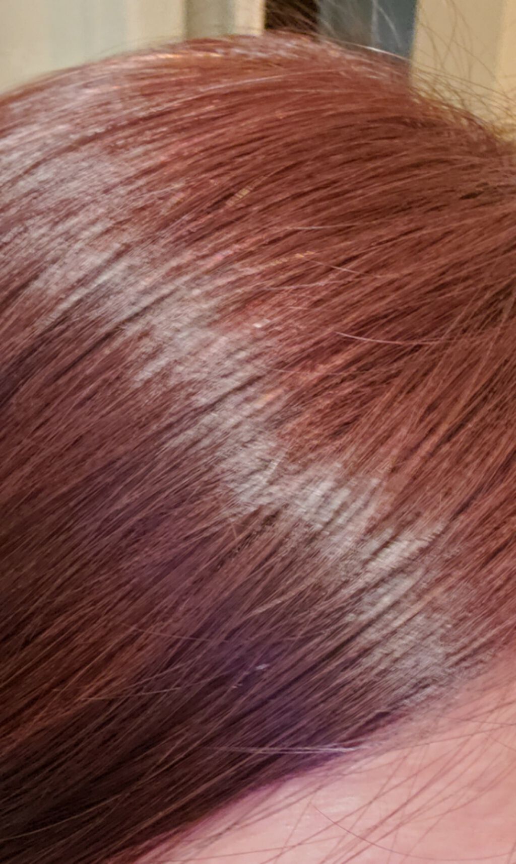 ヒアルロン酸/oneskin/美容液を使ったクチコミ（3枚目）