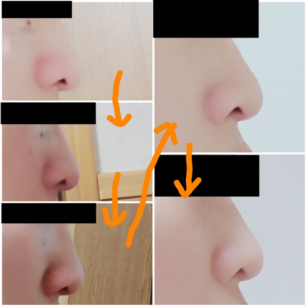 ノーズトレーナー/DAISO/その他スキンケアグッズを使ったクチコミ(3枚目)