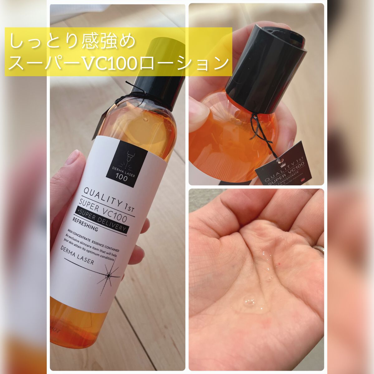 ダーマレーザー スーパーVC100ローション（さっぱり）/クオリティファースト/化粧水を使ったクチコミ（1枚目）