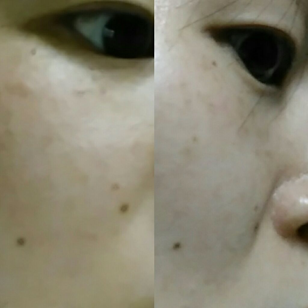 オールインワン シズカゲル/Shizuka BY SHIZUKA NEWYORK/オールインワン化粧品を使ったクチコミ(1枚目)