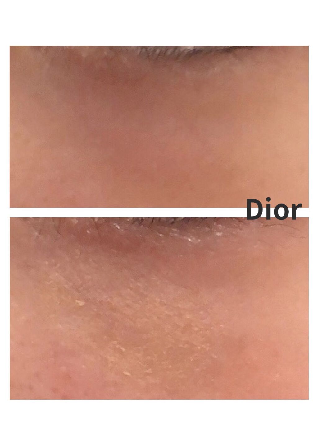 【旧】ディオールスキン フォーエヴァー スキン コレクト コンシーラー/Dior/リキッドコンシーラーを使ったクチコミ（3枚目）
