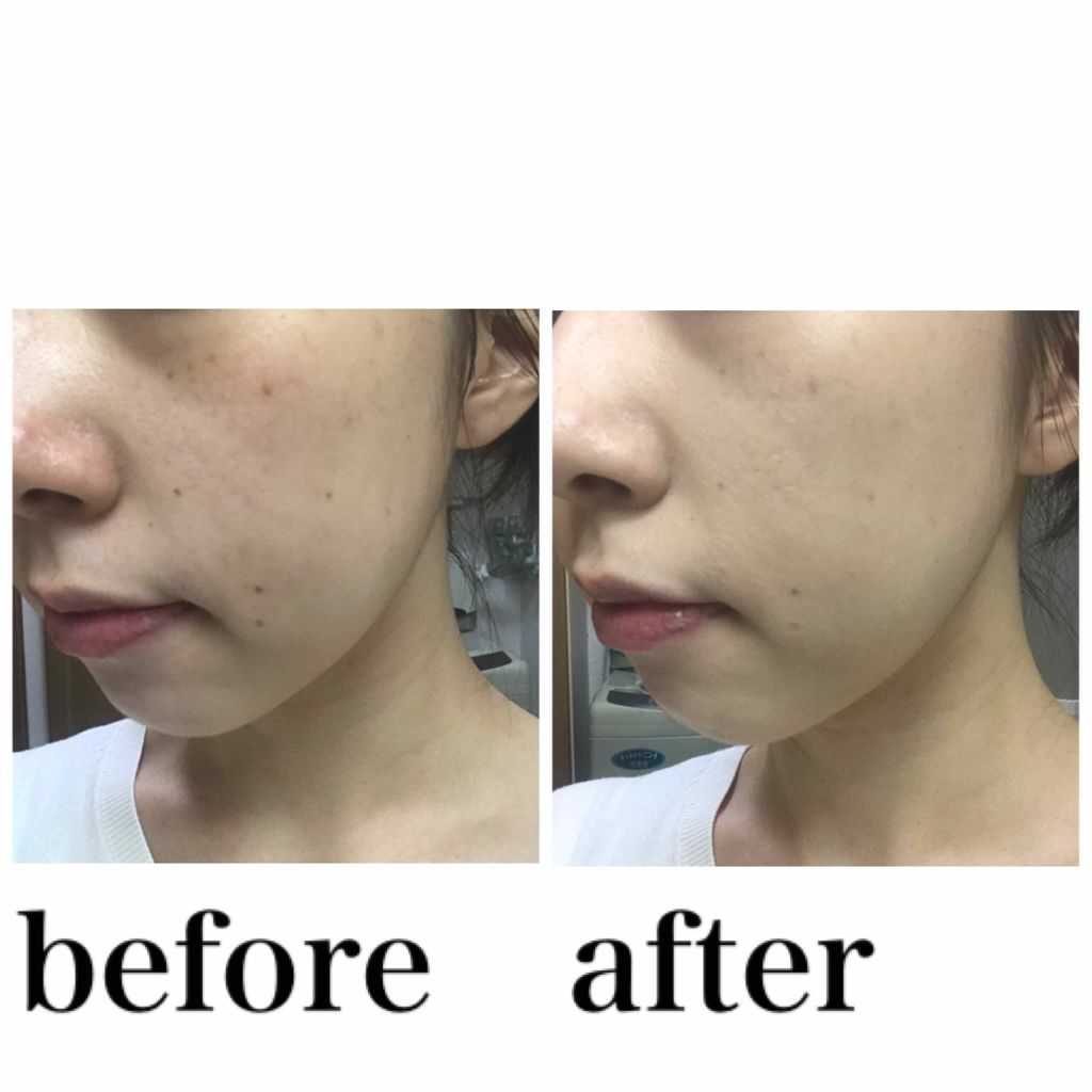 NUDISM MOIST COVER CUSHION/CLIO/クッションファンデーションを使ったクチコミ(3枚目)