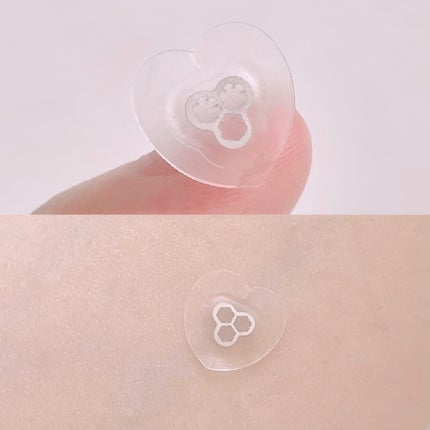 ACマグネシウムパッチ ミニ/スノーツープラス/にきびパッチを使ったクチコミ(5枚目)