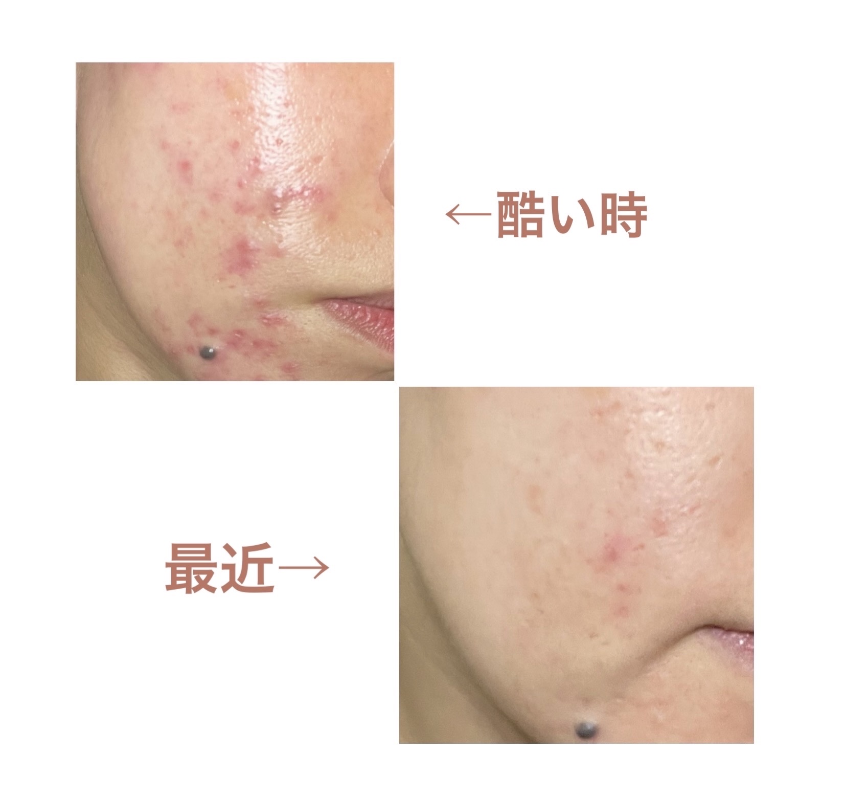 クリアフル ローションM(しっとりタイプ)/オルビス/化粧水を使ったクチコミ（2枚目）