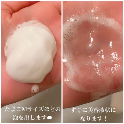 炭酸ホットクレンジング/肌ナチュール/その他洗顔料を使ったクチコミ(2枚目)