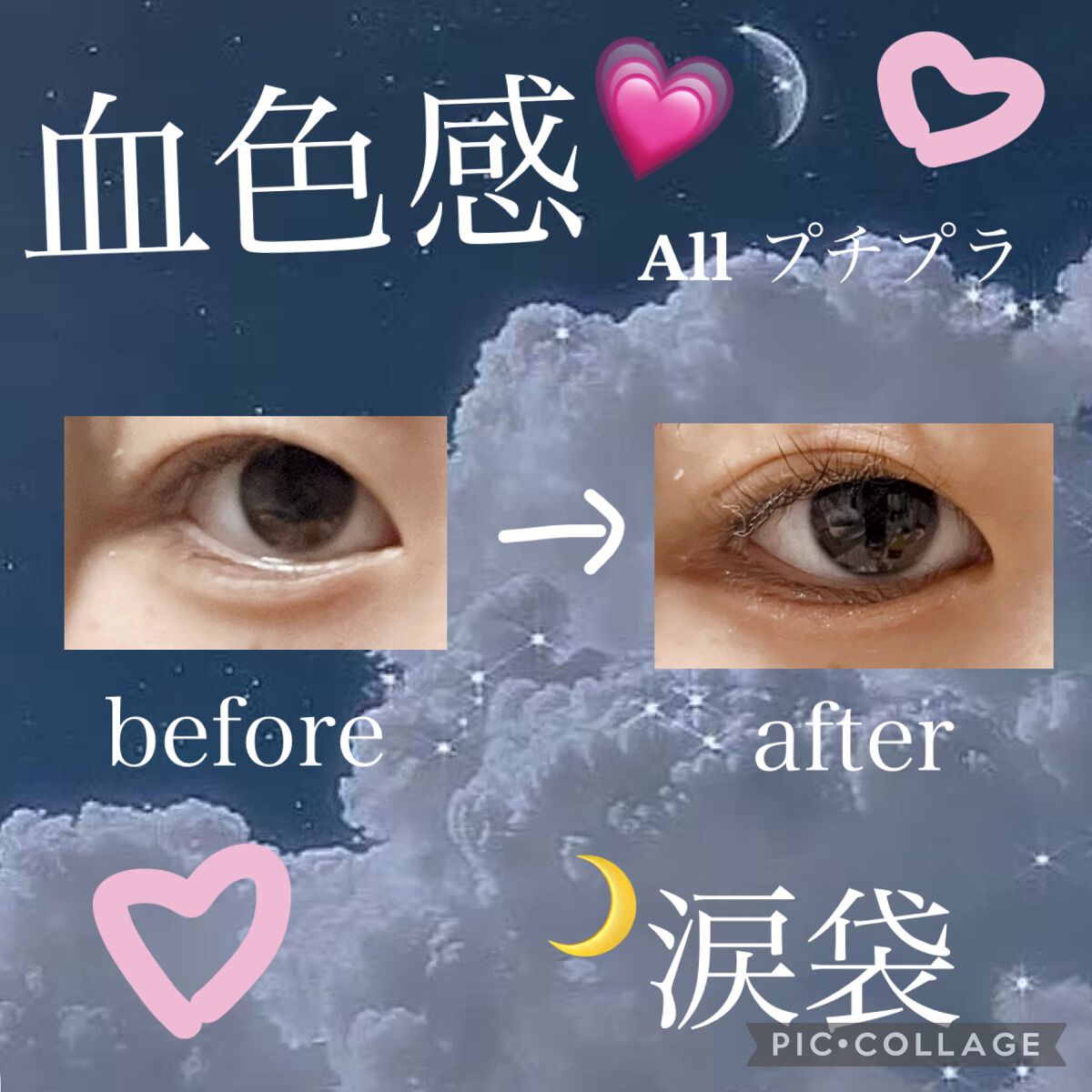 カラーミキシングコンシーラー/キャンメイク/パレットコンシーラーを使ったクチコミ（1枚目）