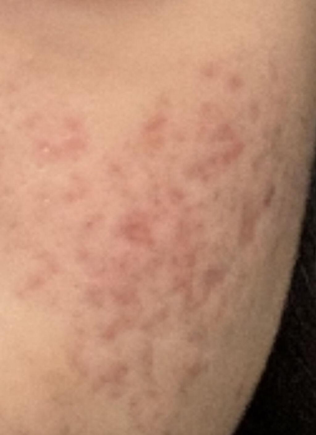 お米のパック/毛穴撫子/洗い流すパック・マスクを使ったクチコミ（3枚目）