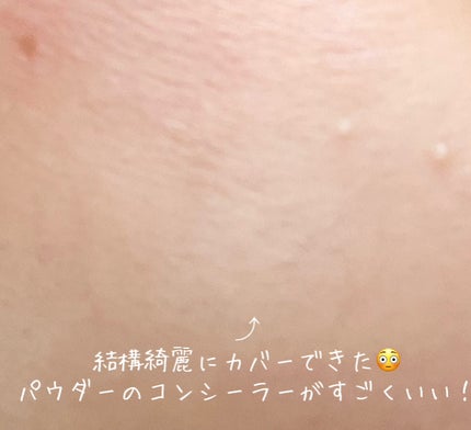 ダブルラスティング コンシーラーパレット/ETUDE/パレットコンシーラーを使ったクチコミ(5枚目)