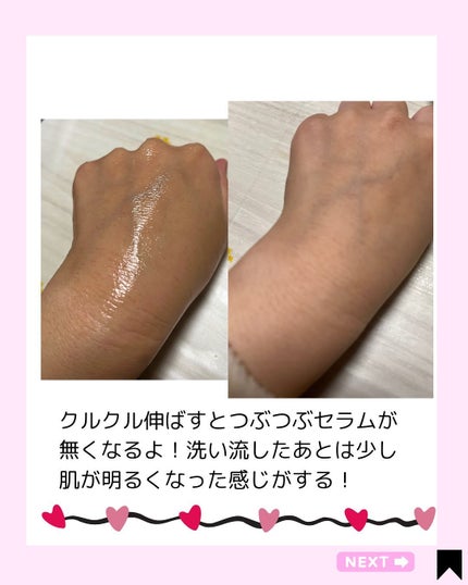 Kana on LIPS 「ビタミン足りてる?/こんにちは♪カナです✨️今日も投稿見てくれ..」(7枚目)