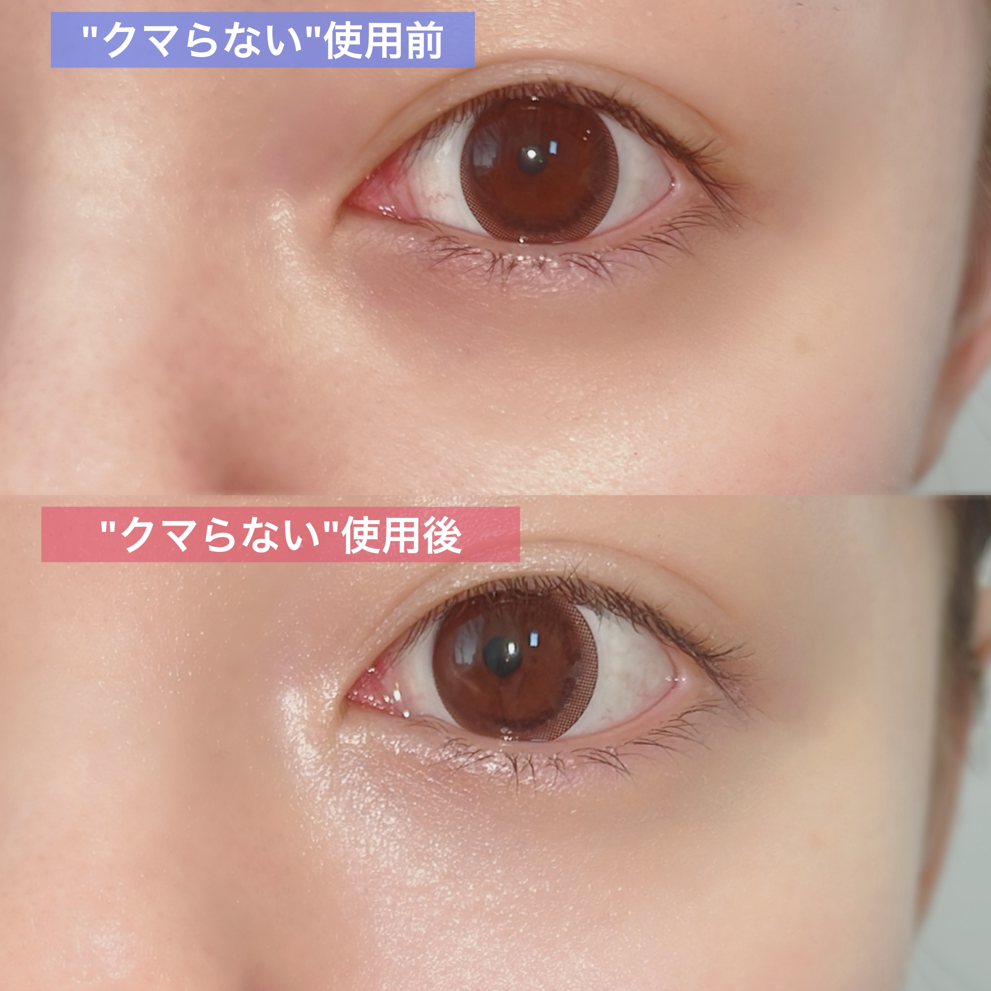 売り切れ殺到中の「クマらない」アイクリームのカバー力が本物だったのでレビューします🩷🤍

✼••┈┈••✼••┈┈••✼••┈┈••✼••┈┈••✼

クリアターン
ごめんね素肌 クマらないアイクリーム
¥990 ←参考価格

✼••┈