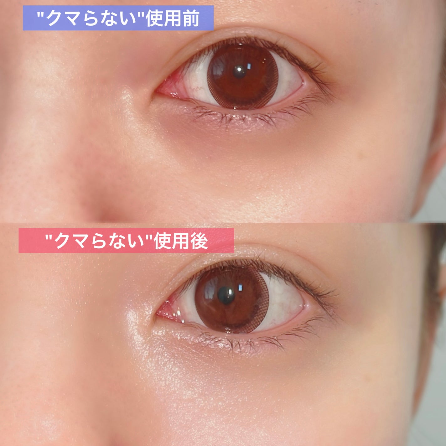 ごめんね素肌 クマらないアイクリーム/クリアターン/アイケア・アイクリームを使ったクチコミ(1枚目)