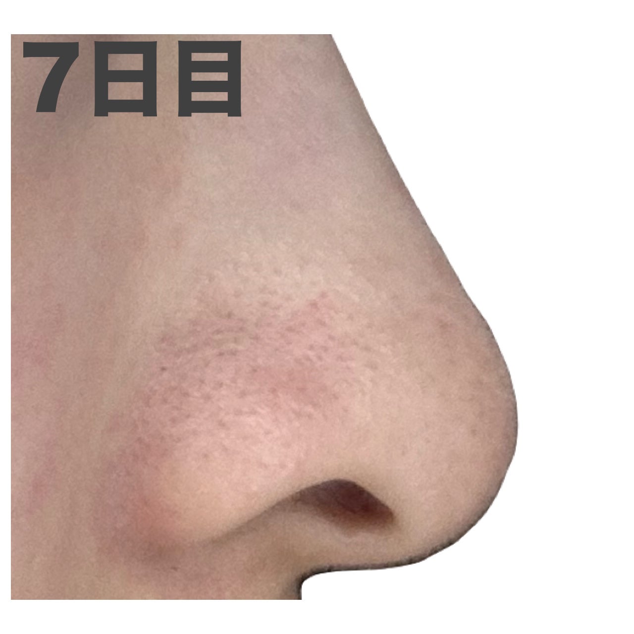 デュオ ザ クレンジングバーム ブラックリペア /DUO/クレンジングバームを使ったクチコミ(7枚目)