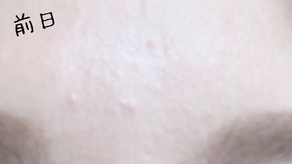 ティーツリーケア ソリューション エッセンシャルマスクEX/MEDIHEAL/シートマスク・パックを使ったクチコミ（1枚目）